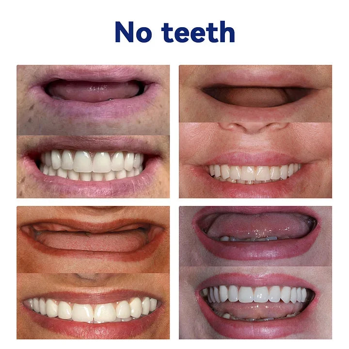 Dentures Flexible Upper & Lower Set Waterproof