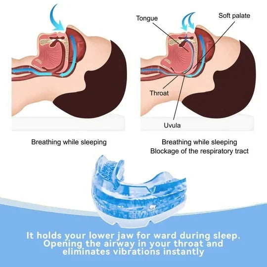 Anti-Snore Mouthpiece Adjustable Washable & Reusable