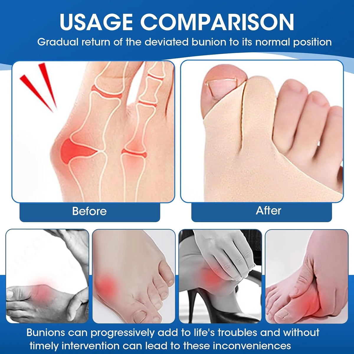 Big Toe Corrector Low-Profile Stretch Fabric Hand-Washable & Reusable
