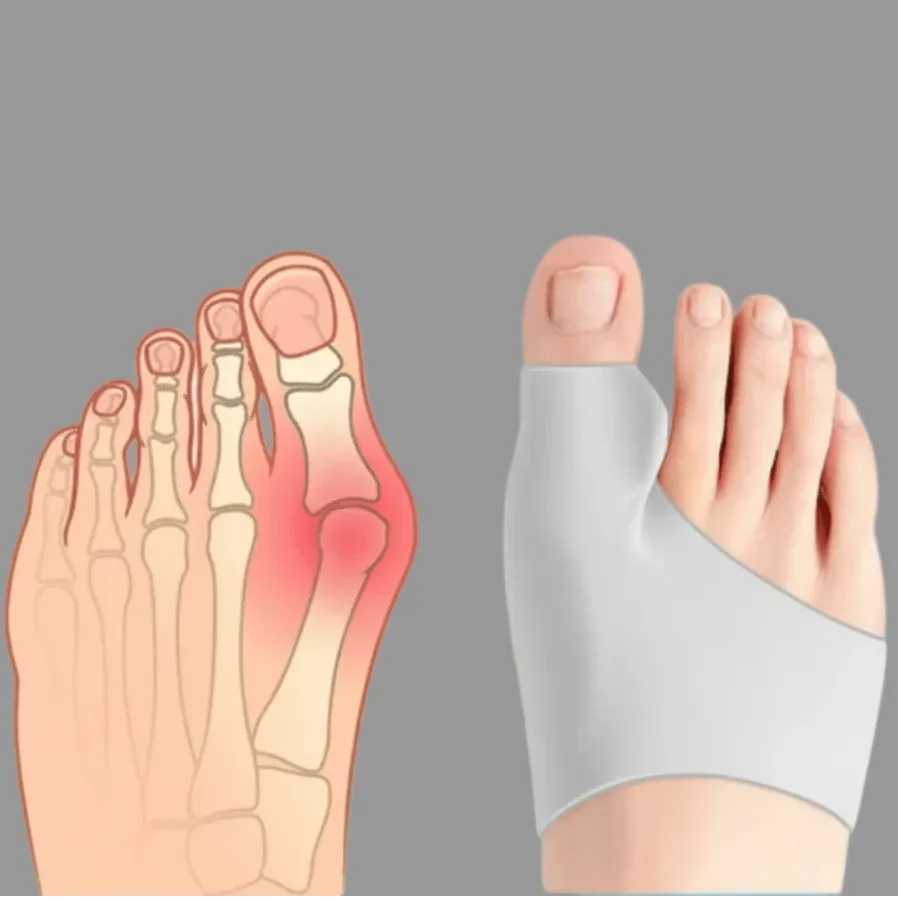 Bunion Corrector Breathable Discreet Set of 2