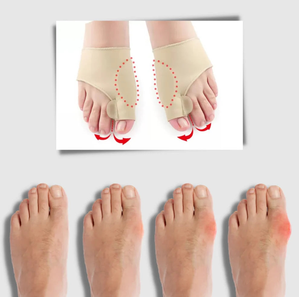 Bunion Corrector Silicone Gel Toe Separator Pair
