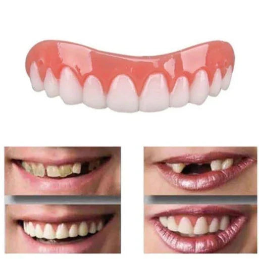 Dental Veneer Cover Removable & Reusable Natural-Looking Finish