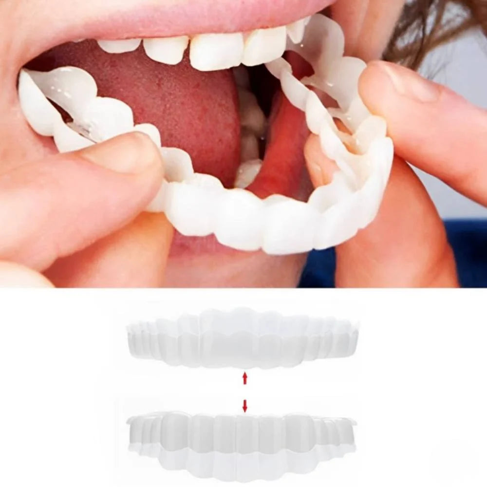 Dental Veneers Clip-On Upper & Lower Reusable Set
