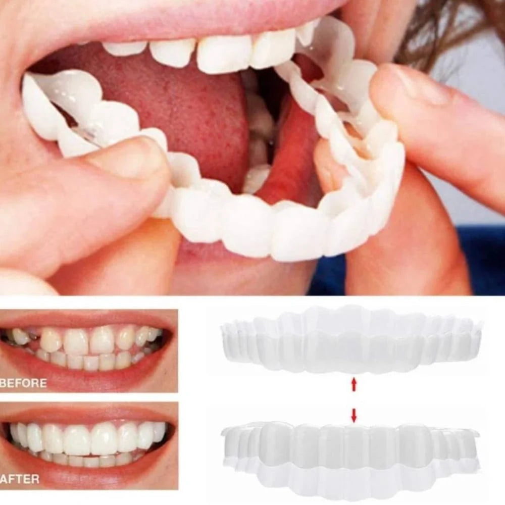 Dental Veneers Clip-On Upper & Lower Reusable Set