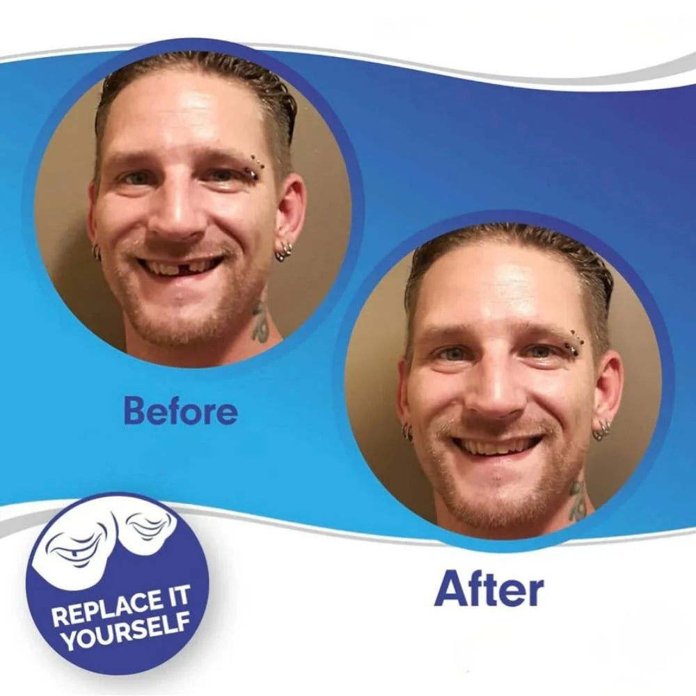 Dental Veneers Clip-On Upper & Lower Reusable Set