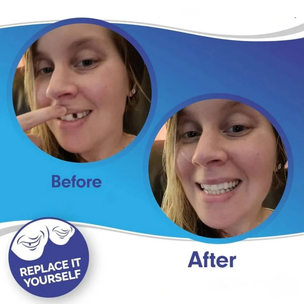 Dental Veneers Clip-On Upper & Lower Reusable Set