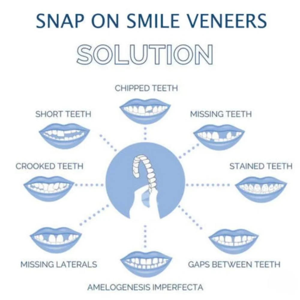 Dental Veneers Clip-On Upper & Lower Reusable Set