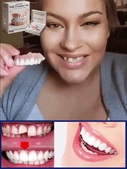 Denture Kit Moldable Reusable Upper & Lower Set
