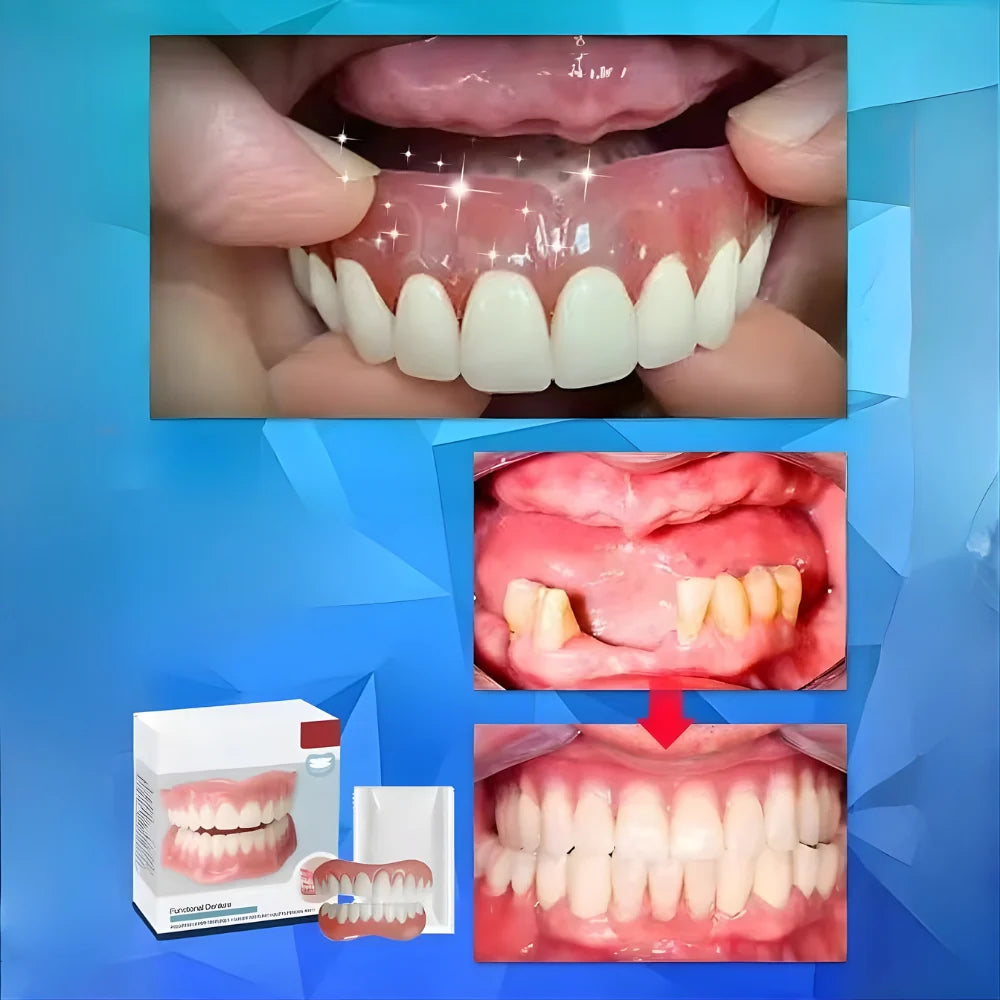 Denture Set Moldable Custom-Fit Upper & Lower