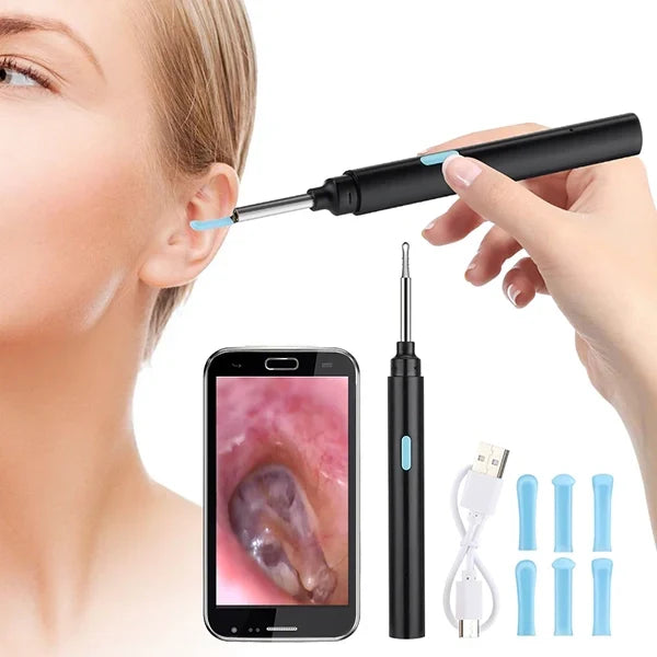 Ear Camera Scope 20X Magnification Wireless App Connection Anti-Fog Lens