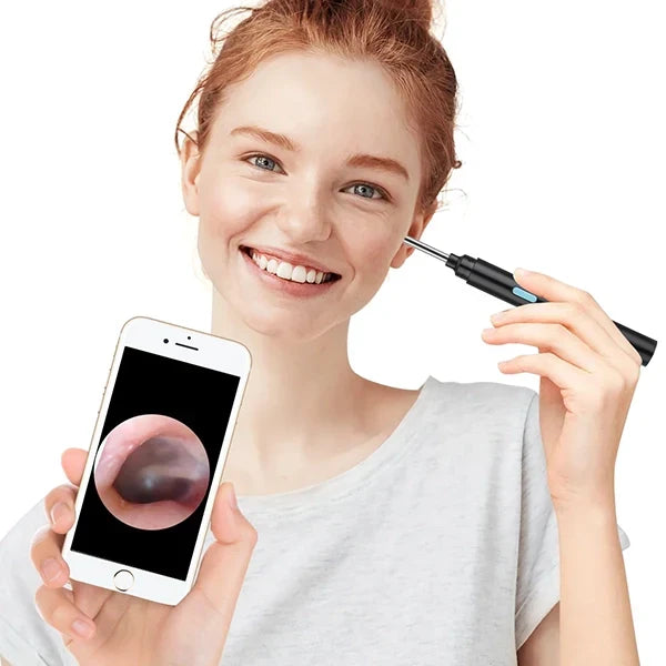Ear Camera Scope 20X Magnification Wireless App Connection Anti-Fog Lens