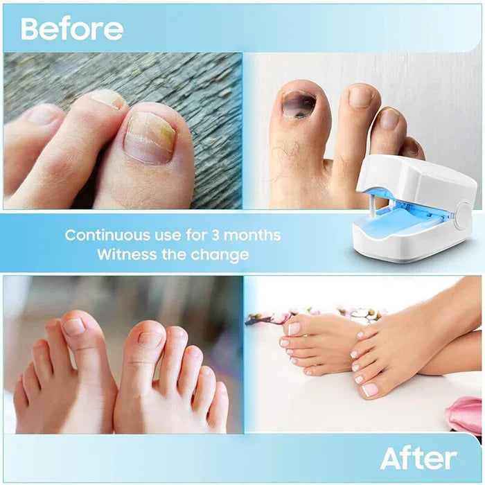 Nail Care Device Focused Light Rechargeable Cordless