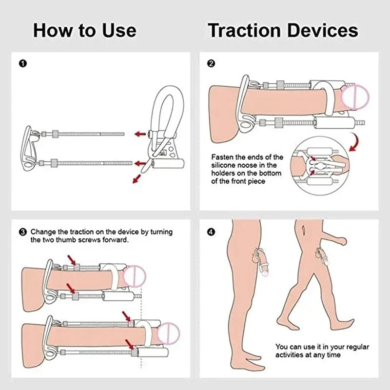 Penile Traction Device Adjustable Tension Stainless Steel