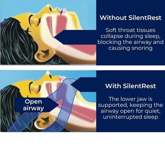 Sleep Chin Strap Adjustable Lightweight Jaw Support