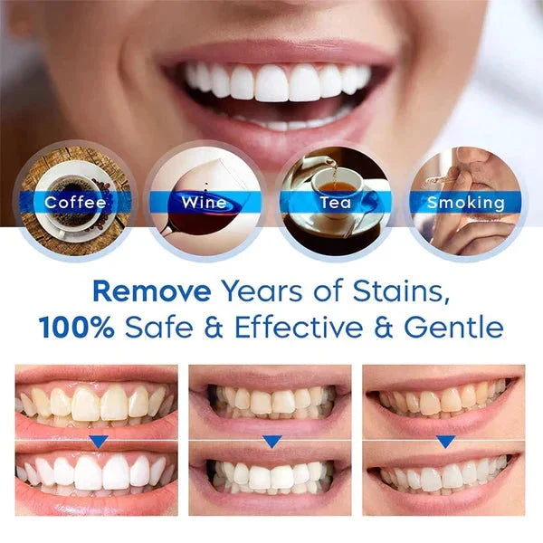 Teeth Whitening Pen Portable Precision Applicator Gentle Formula