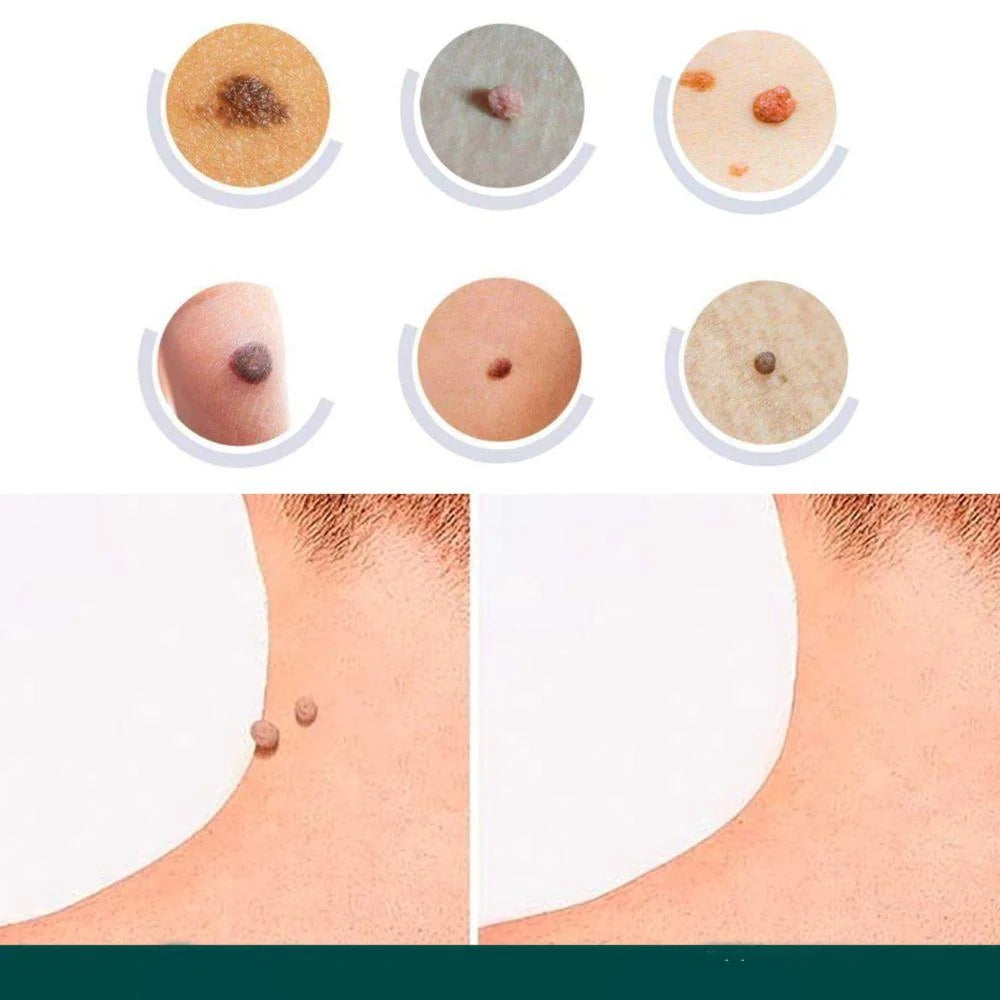 Wart & Skin Tag Patches Transparent Hydrocolloid 120 Count