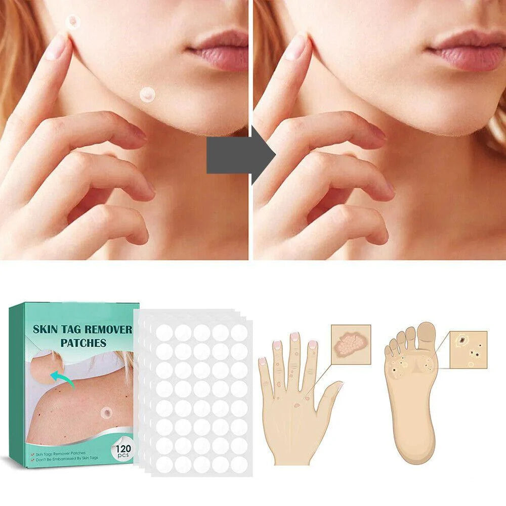 Wart & Skin Tag Patches Transparent Hydrocolloid 120 Count